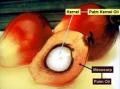 Palm Oil