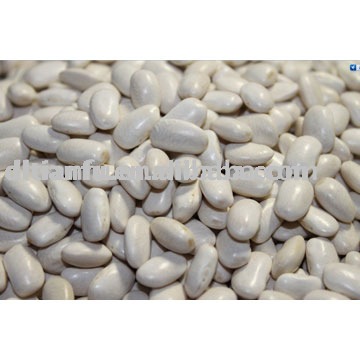 High-Quality Chinese  latest  crop  Middle Organic White Kidney Bean