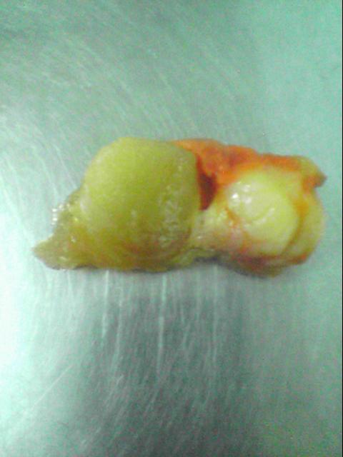 Clam