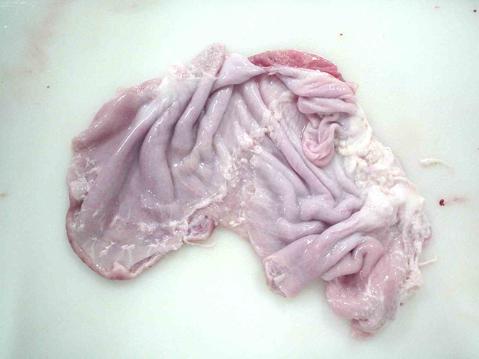 Stomach