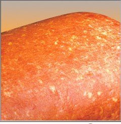 Fixed Circumference    ham