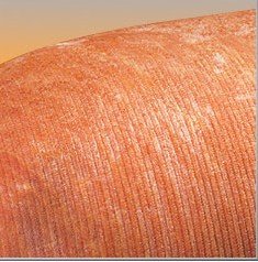 Spiral  ham