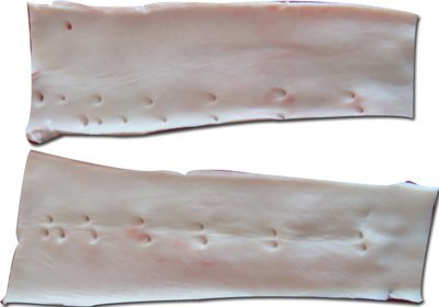 Aorta