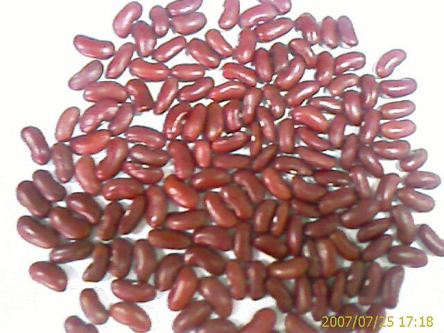  speckled   red   kidney   beans 