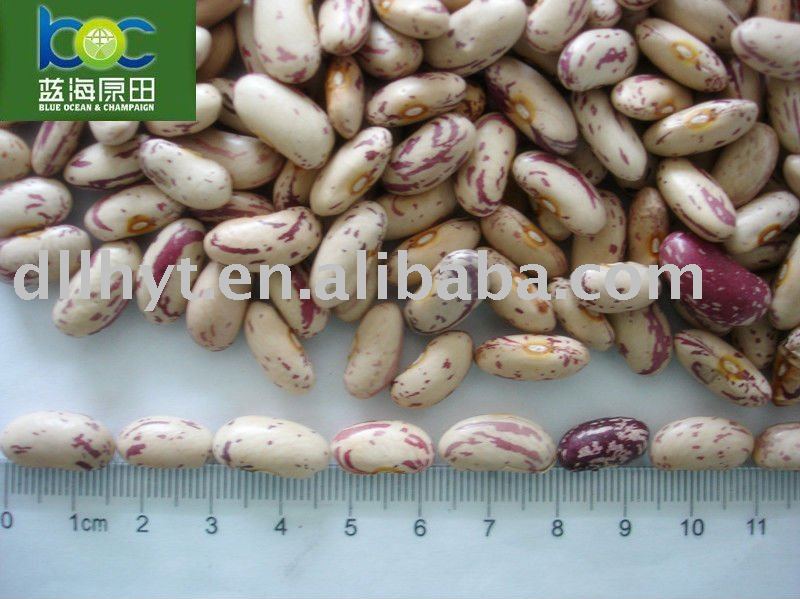  Light   Specked  Kidney  Beans  Long Shape