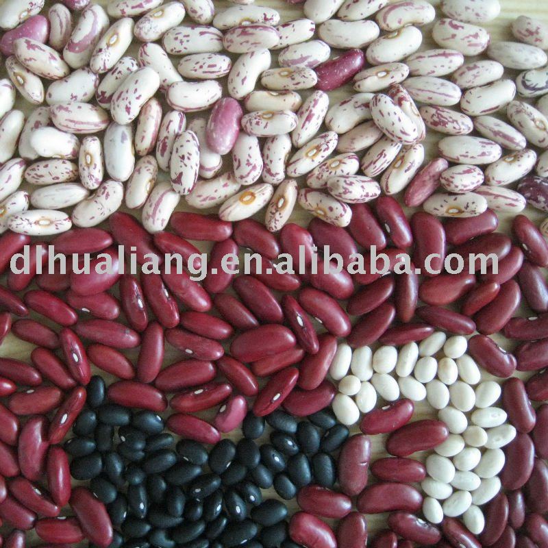 white/red /black/light speckled kidney beans