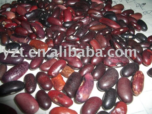 yzt red kidney beans