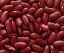 we supply all kinds of kidney beans