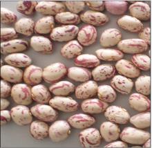  Light   Speckled   Kidney   Bean s Round Shape