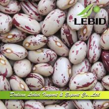 American Type  Light  Speckled Kidney  Bean s Round Shape