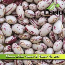 Light Speckled Kidney Beans, American Round Shape, Beans for Sale