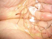 Glass Eels