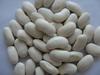 White Kidney Beans