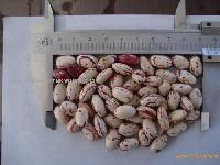 Light speckled kidney beans